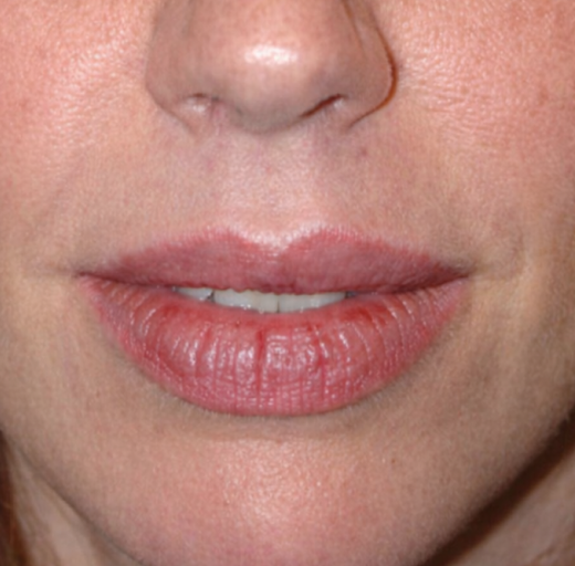 Before/After Image